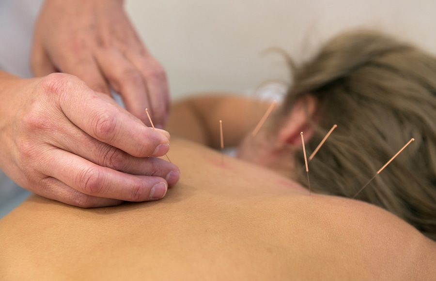 Acupuncture for lower back pain