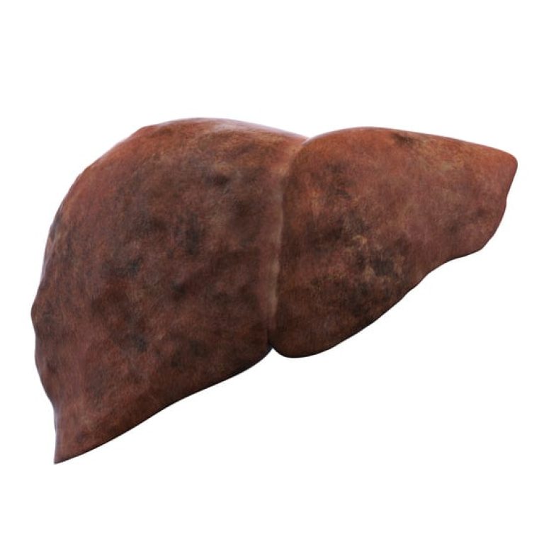 Fatty-Liver